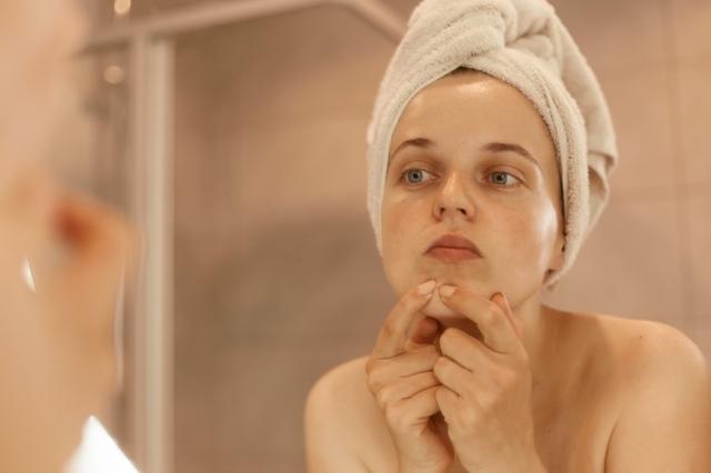 bscesses and acne