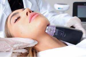 Morpheus8 for flawless skin Morpheus8 for flawless skin